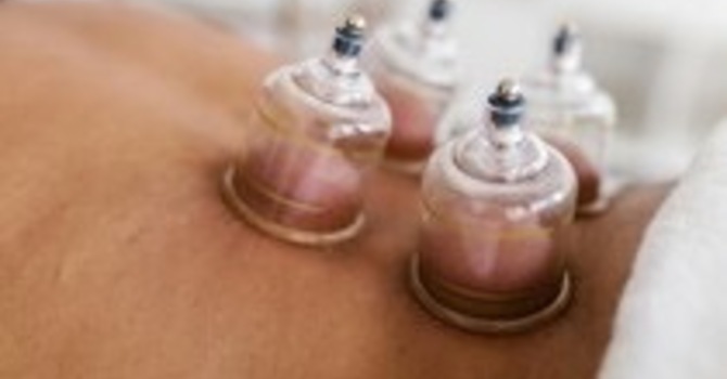 Myofascial Decompression/Cupping